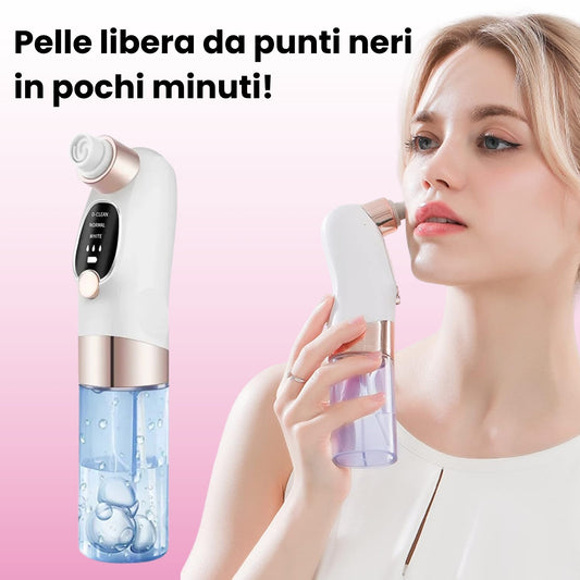 Aspiratore Punti Neri con Tecnologia ad Acqua