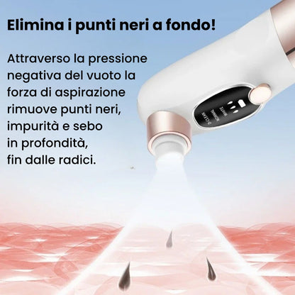 Aspiratore Punti Neri con Tecnologia ad Acqua