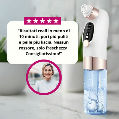 Aspiratore Punti Neri con Tecnologia ad Acqua