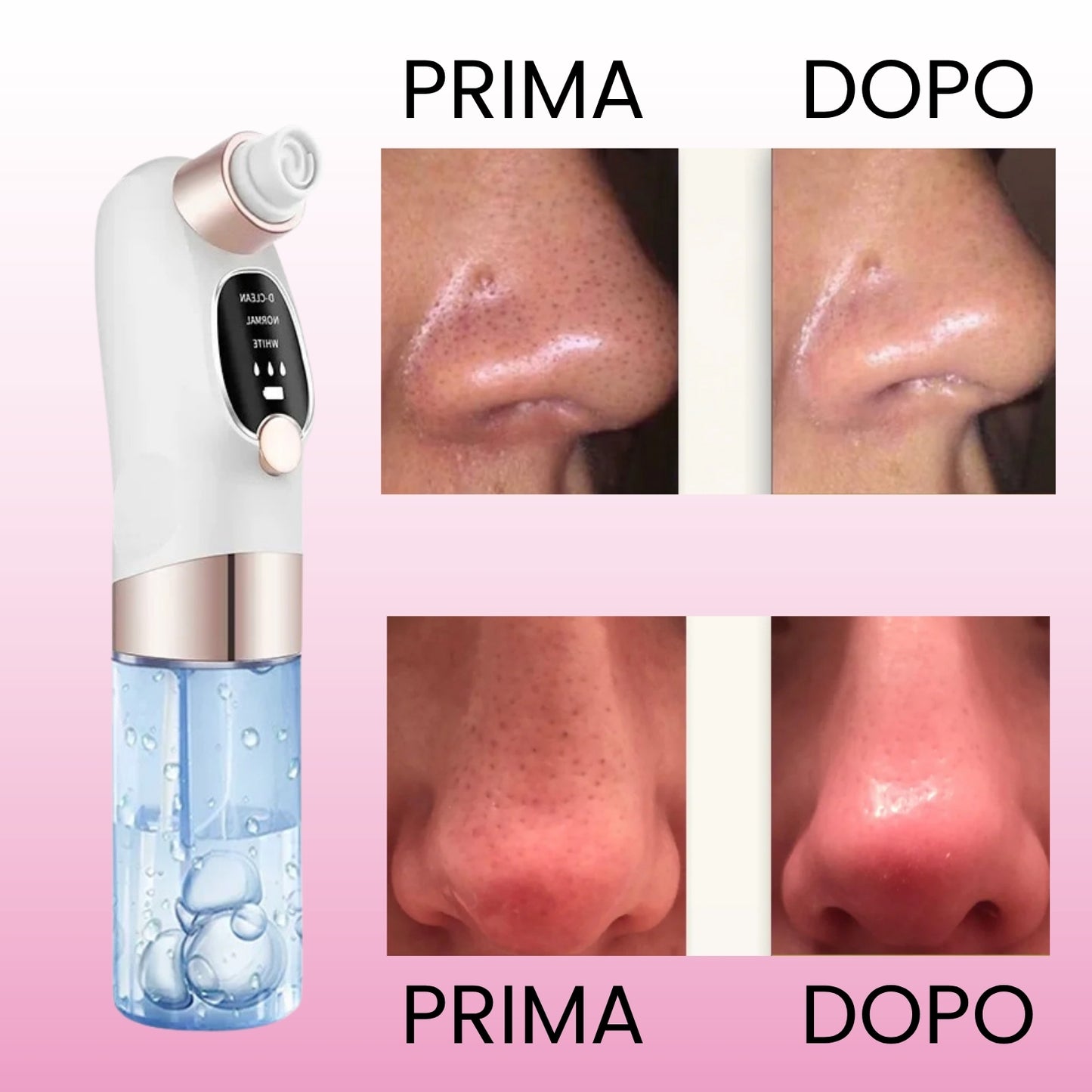 Aspiratore Punti Neri con Tecnologia ad Acqua
